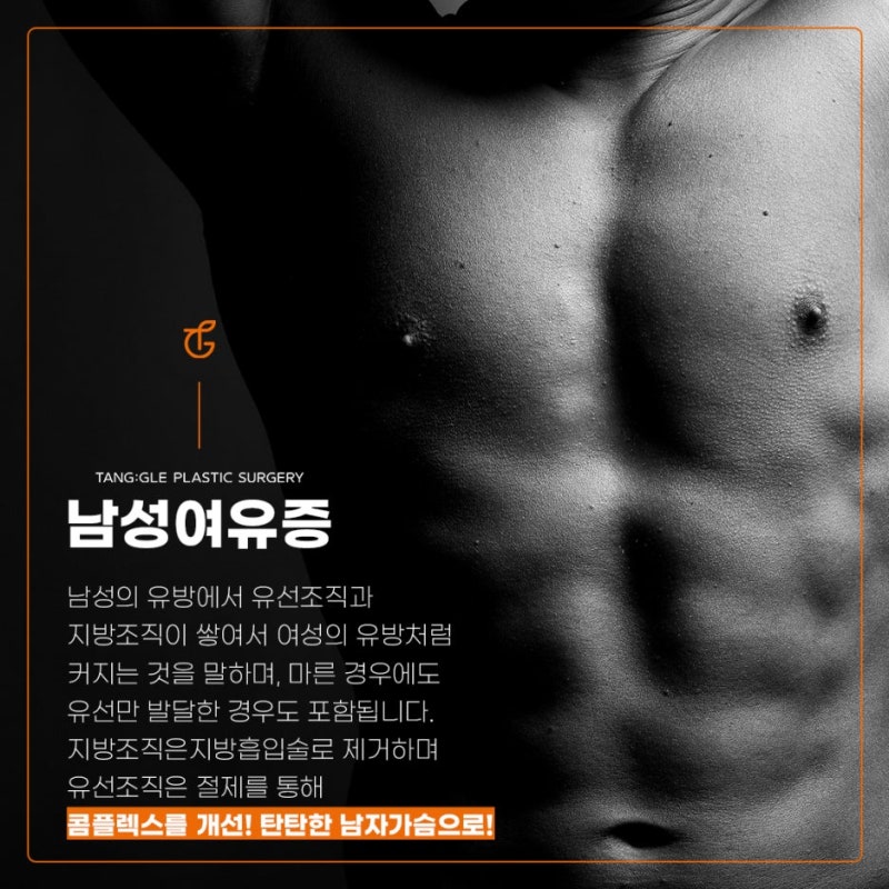 여성형 유방증 원인과 치료방법! 사진 2