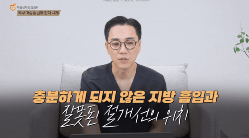 복부성형술, 모르면 재수술 하게 됩니다 사진 2
