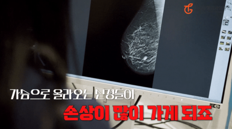 처진가슴리프팅, 흉터 걱정되시는 분은 주목!