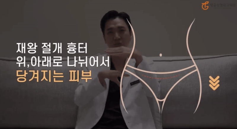 복부거상수술비용, 저렴한 병원의 숨겨진 위험 사진 2