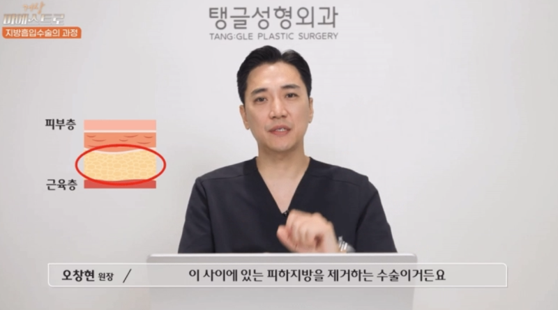 배지방흡입, 3일 뒤 피부가 울퉁불퉁해진 이유 사진 2