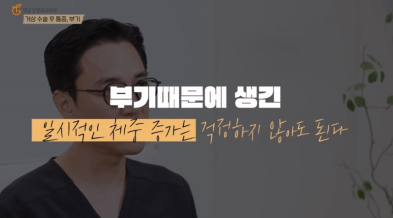 복부성형, 회복기간 망치는 행동 사진 3