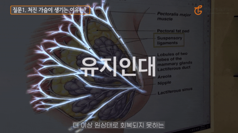 가슴거상수술, 처진 모양 해결 방법
