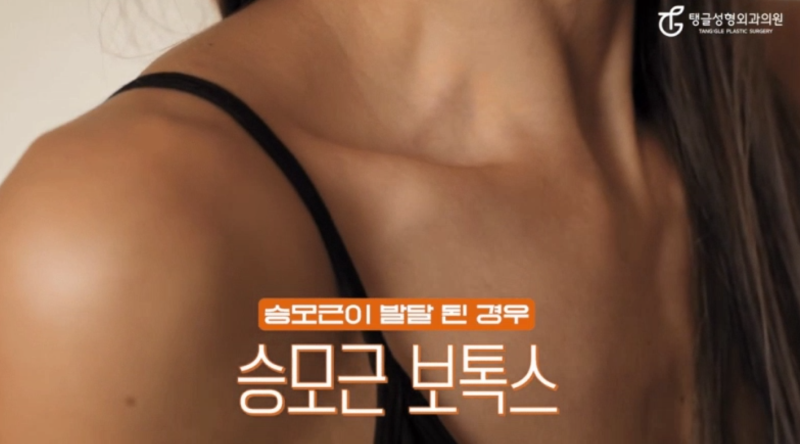 어깨필러, 직각어깨를 만드는 가장 빠른 방법은? 사진 4