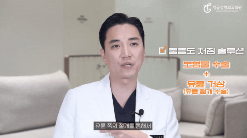 가슴거상술, 운동으로 해결하고 싶다면 사진 4