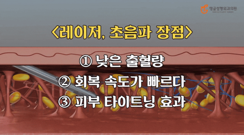 다이어트처진살, 모두에게 정답은 아닙니다 사진 2