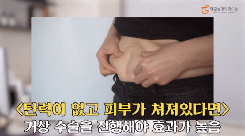 다이어트처진살, 모두에게 정답은 아닙니다 사진 3