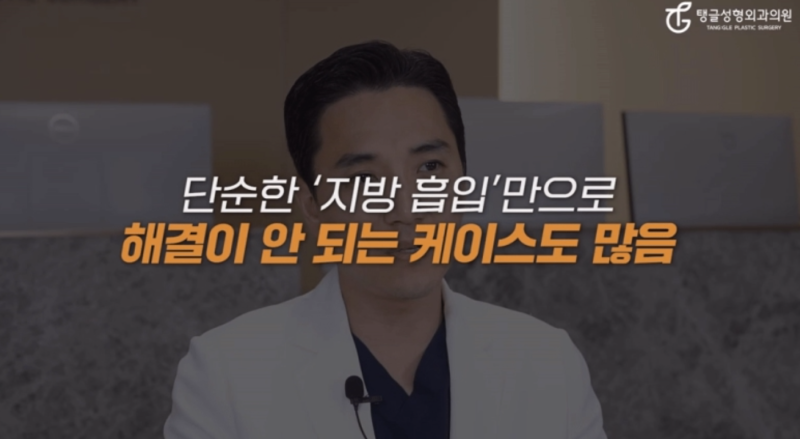 배지방흡입, 거상술까지 해야 되는 이유 사진 2