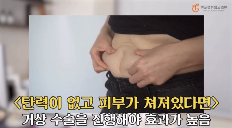 복부지흡, 이런 분은 받으면 후회합니다 사진 2