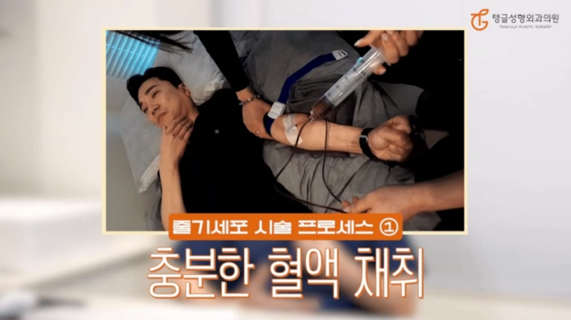 줄기세포정맥주사 피부 노화 치료 될까?