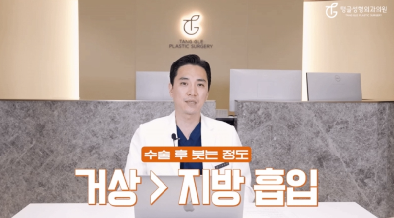 팔뚝거상, 모두에게 필요한가요? 사진 4
