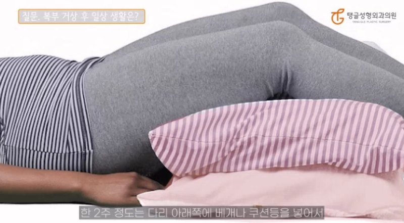 복부성형, 수술 후 관리 방법과 주의사항 사진 2