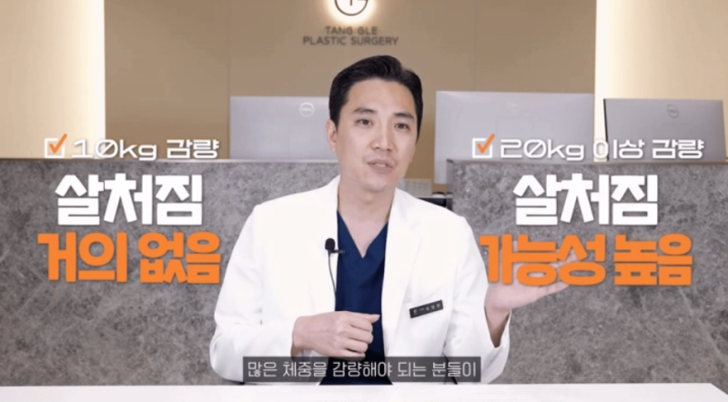 처진살수술, 급하게 다이어트 하셨나요? 사진 3