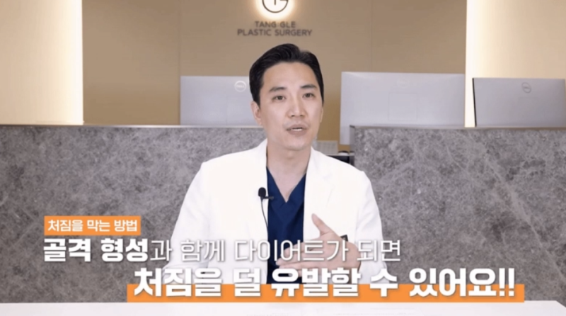 처진살수술, 급하게 다이어트 하셨나요? 사진 4