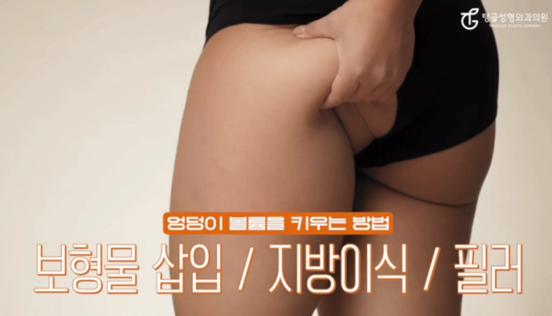 엉덩이성형, 힙업거상술을 아세요? 사진 2