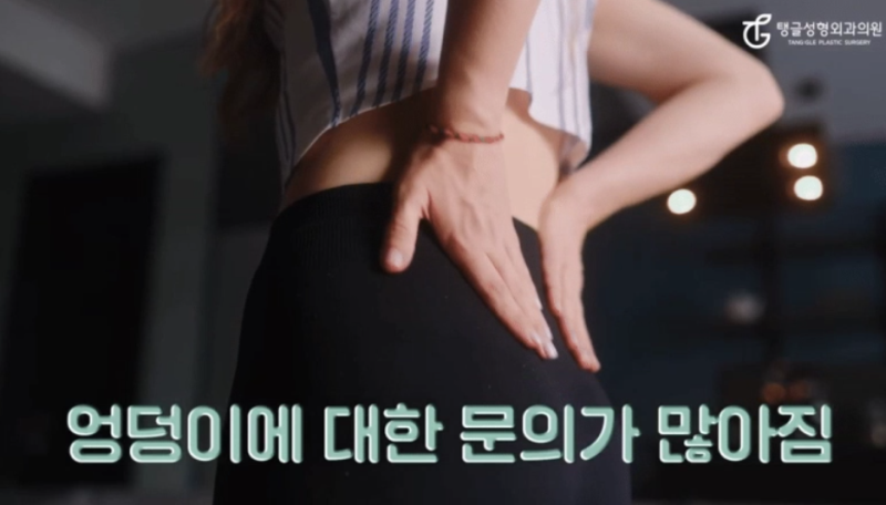 엉덩이성형, 힙업거상술을 아세요?