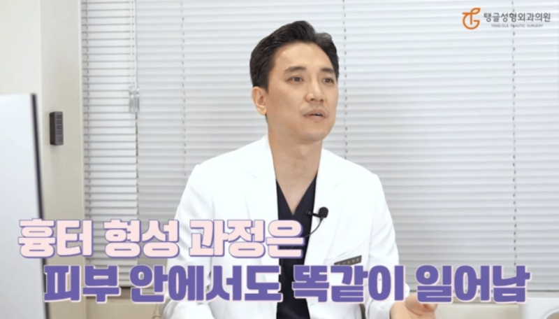 복부거상술, 지방흡입만 하면 안 돼요 사진 3