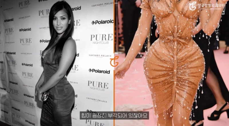 엉덩이리프팅, 골반 가질 수 있는 방법 알려드릴게요 사진 3