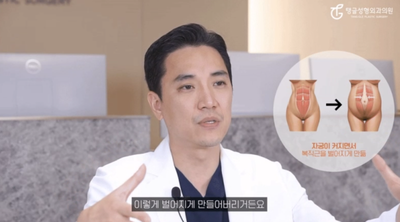 배지방흡입, 이런 분은 효과 없습니다 사진 2