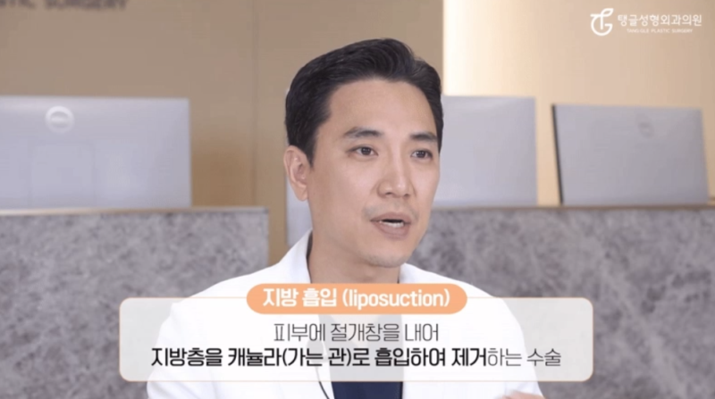 지방흡입수술방법, 정말 효과 있나요?