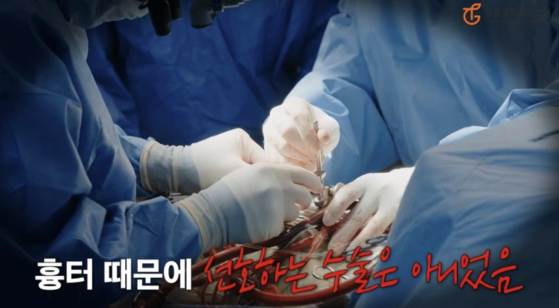 복부거상성형, 부작용 걱정이세요?