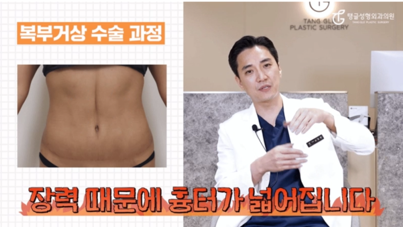 처진뱃살수술, 흉터 때문에 고민이신가요?