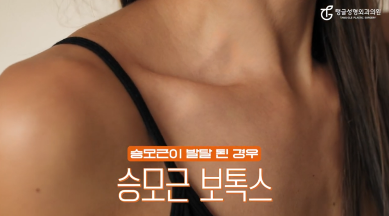 승모근 보톡스 가격, 목 짧아 보인다면