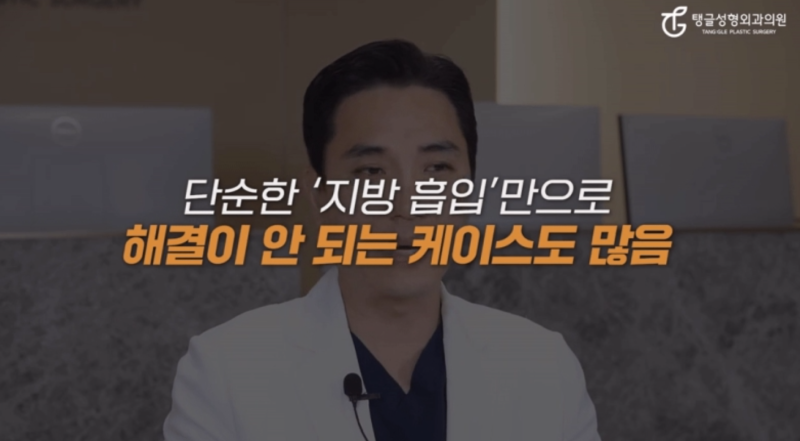 배지방흡입, 제일 최신 버전은? 사진 3