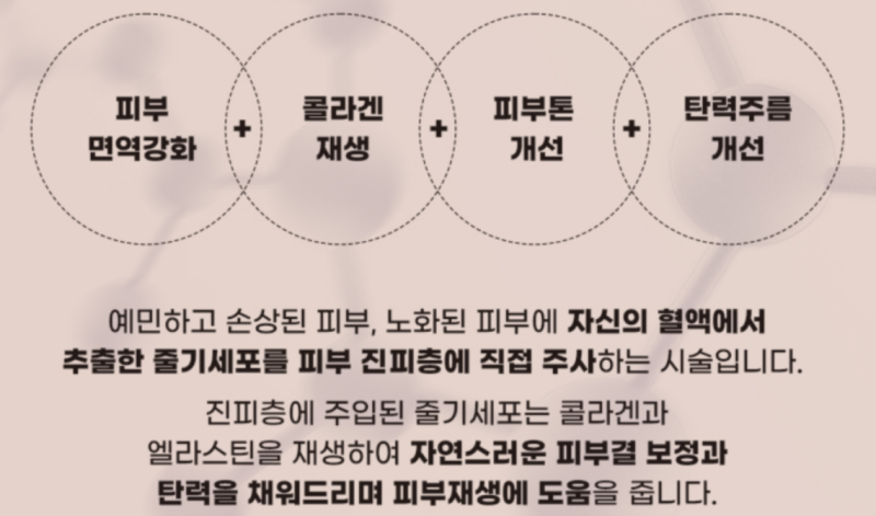 줄기세포 정맥주사, 피부 고민 끝!