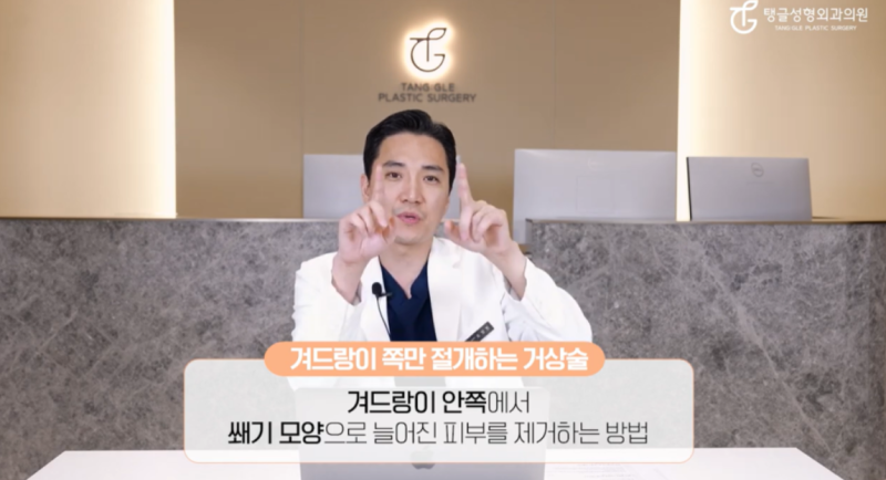 팔뚝살 지방흡입, 정말 필요한가? 사진 2
