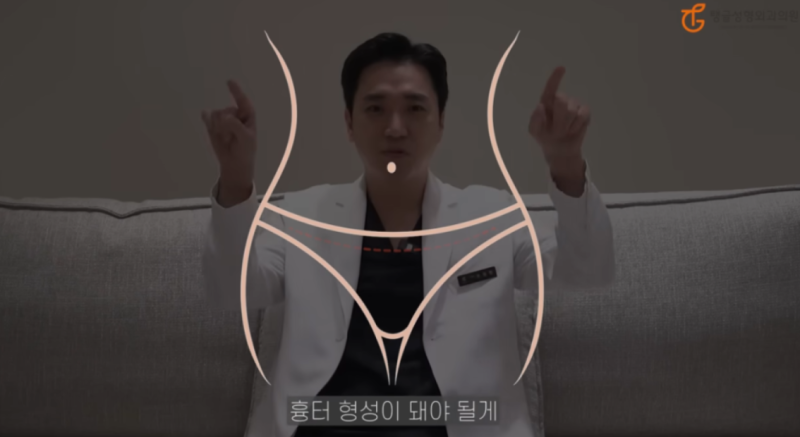 복부지방흡입 부작용, 살 빼는 건 평생 숙제?