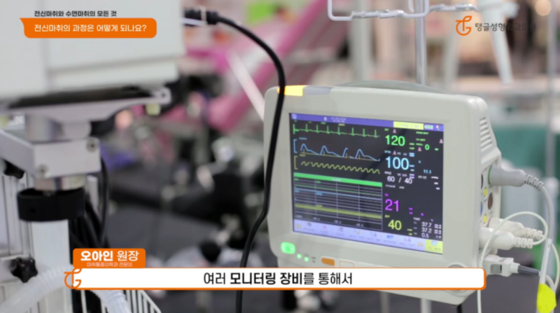 복부거상술, 전신마취 필요한 이유?