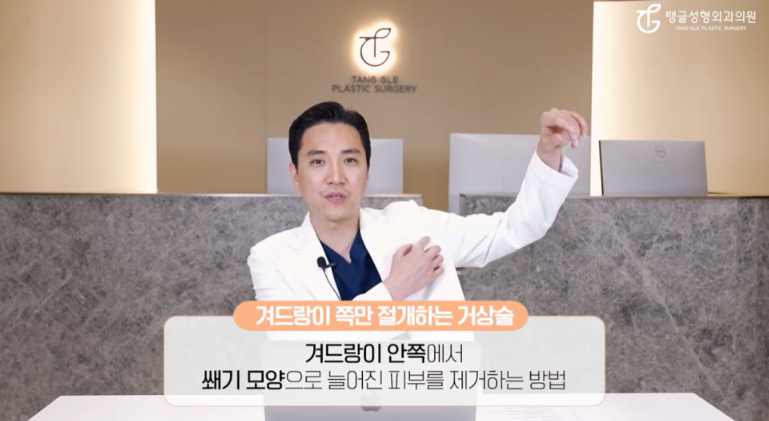 팔거상, 왜 잘 빠지지 않을까?