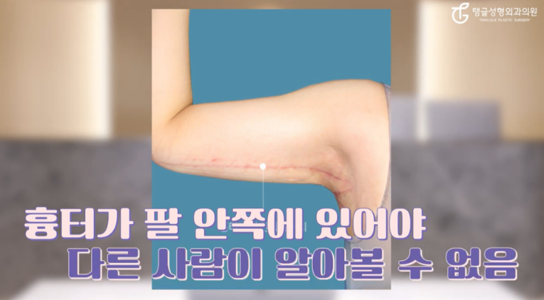 팔거상, 왜 잘 빠지지 않을까?