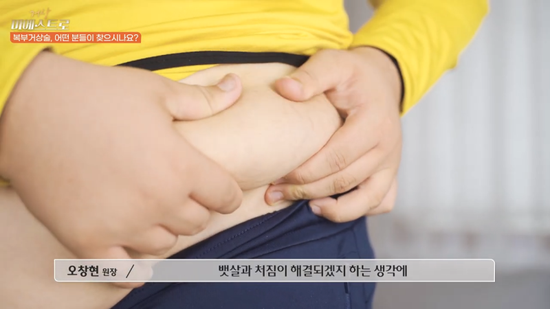 복부거상수술, 고려 중이라면 알아두셔야 할 점 사진 5