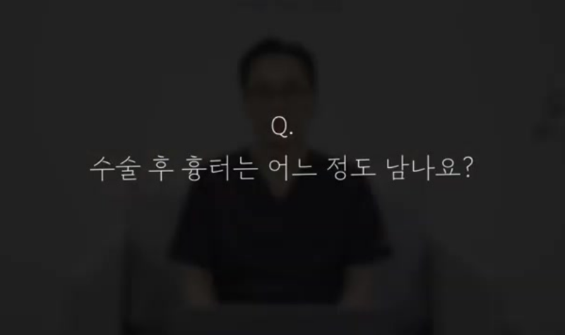 가슴거상수술, 반드시 알아야 될 핵심 정보
