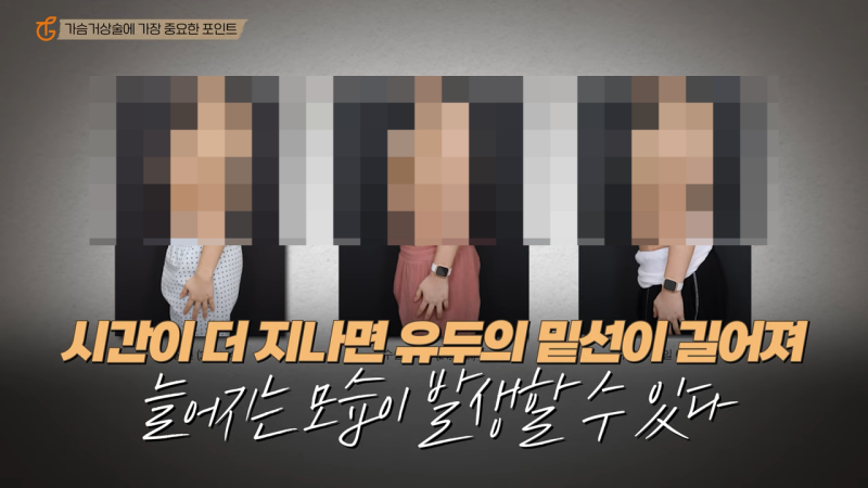 가슴거상수술, 처진 자신감까지 올리는법 사진 5