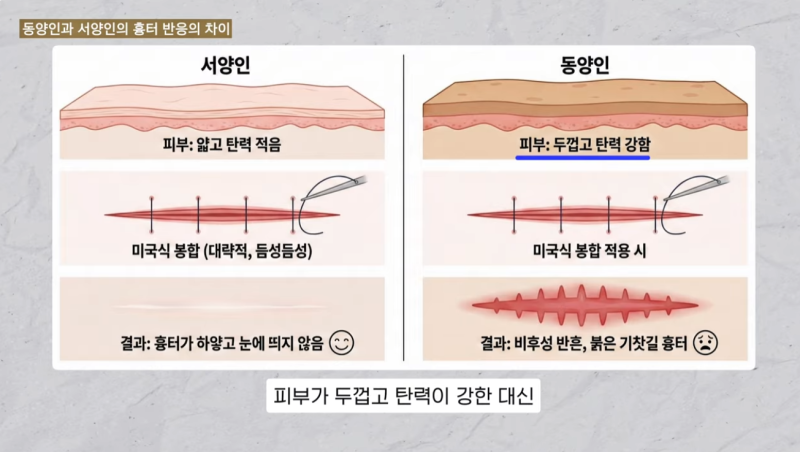 해외 교포들이 한국 성형외과를 고집하는 결정적 차이! 사진 4
