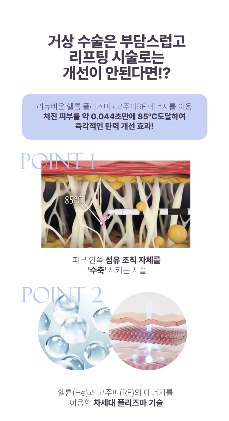 리뉴비온 흉터 없이 지방흡입과 타이트닝을 동시에 사진 3