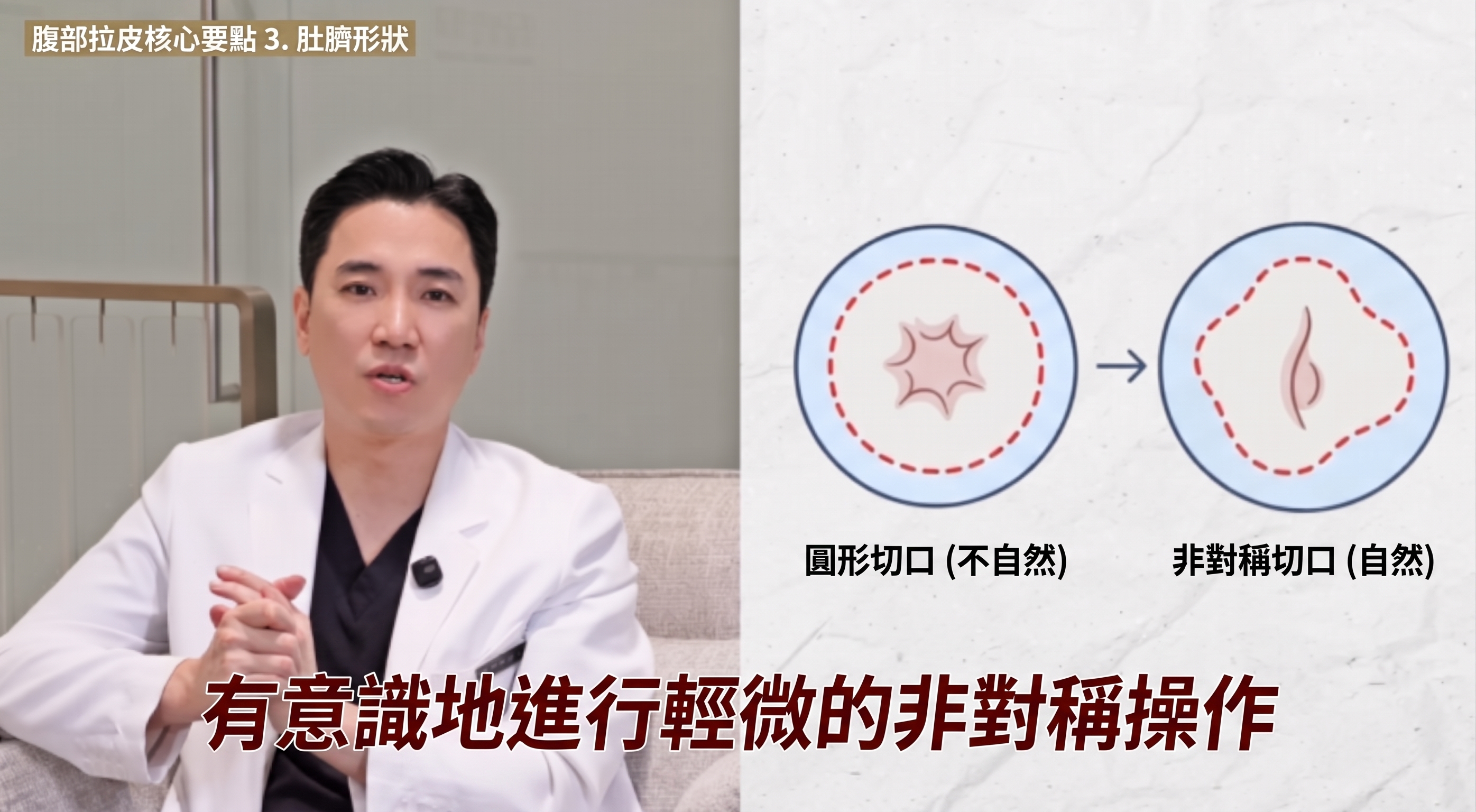 腹部拉皮三大重點：術前務必了解。 사진 5