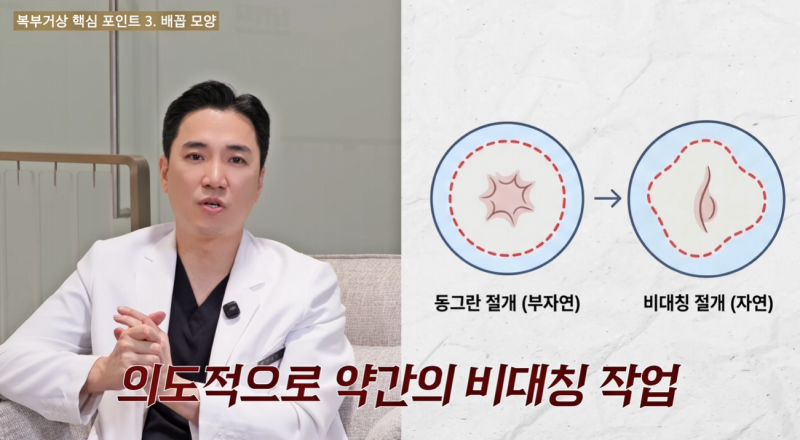 복부거상 3가지 포인트: 수술 전 꼭 알아두세요. 사진 5