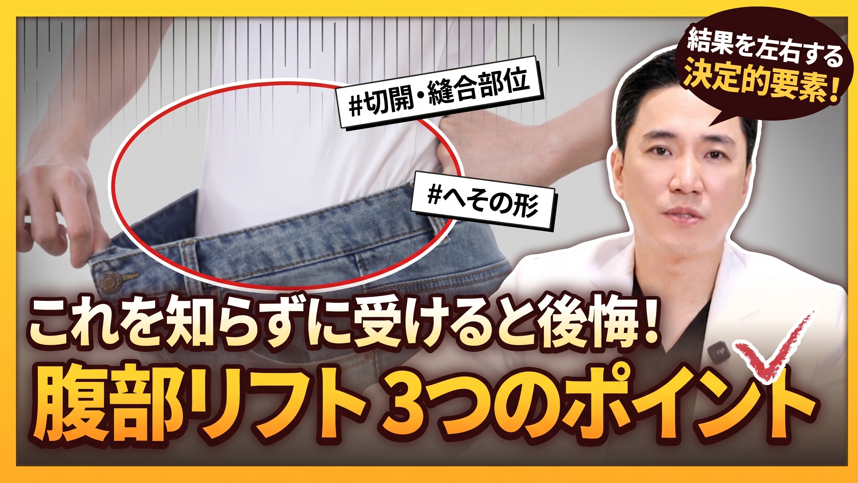 腹部挙上術の3つのポイント:手術前に必ず知っておきましょう。