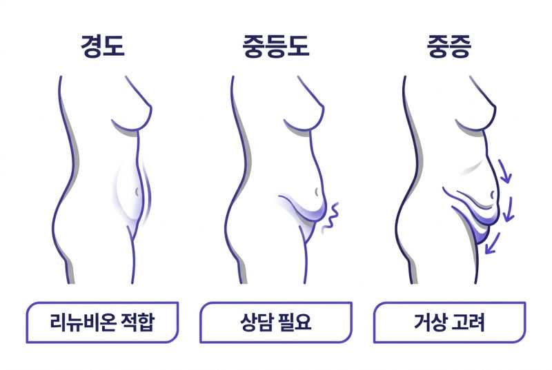 복부 타이트닝 리뉴비온 궁금하신가요? 효과부터 회복까지! 사진 3