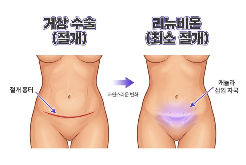 복부 타이트닝 리뉴비온 궁금하신가요? 효과부터 회복까지! 사진 4