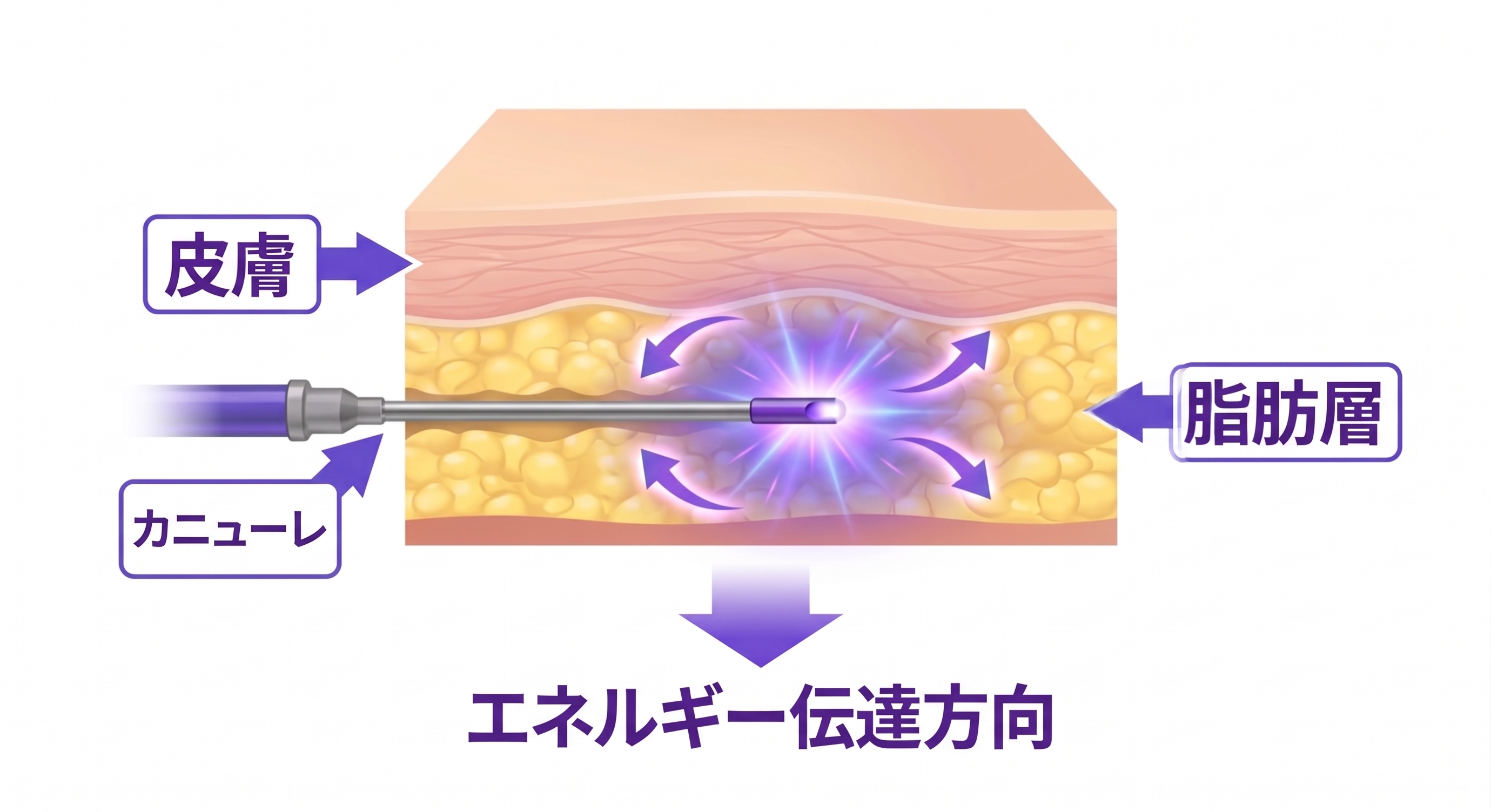 腹部タイトニング リニュービオンにご興味がありますか?効果から回復まで! 사진 2