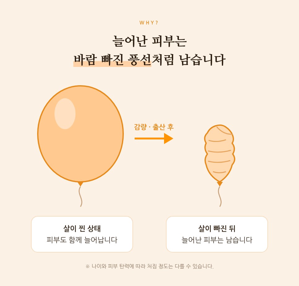 처진 뱃살, 복부거상 수술로 해결하는 방법 사진 3